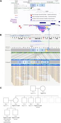 Optical genome mapping in an atypical Pelizaeus-Merzbacher prenatal challenge